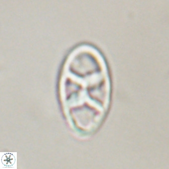 Neococcolithes dubius VR 30850