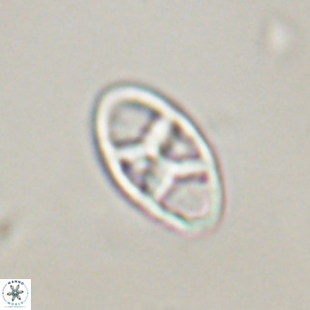 Neococcolithes dubius VR 30851