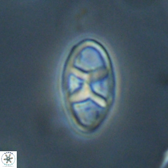 Neococcolithes dubius VR 30853