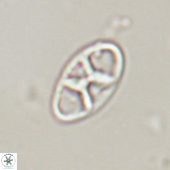 Neococcolithes dubius VR 30855