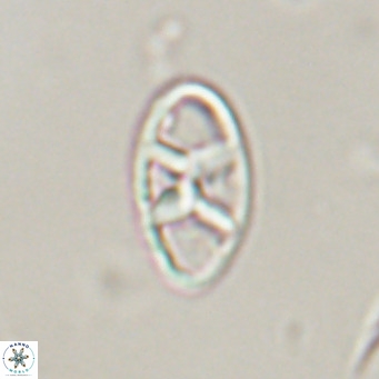 Neococcolithes dubius VR 30856
