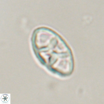 Neococcolithes dubius VR 30857