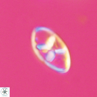 Neococcolithes dubius VR 30858