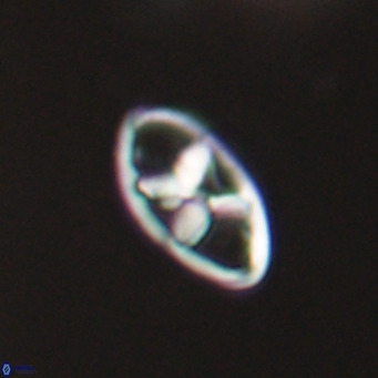 Neococcolithes dubius VR 30859