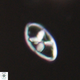 Neococcolithes dubius VR 30859