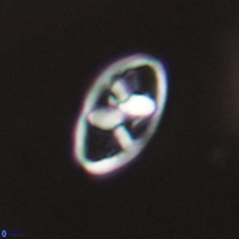 Neococcolithes dubius VR 30861