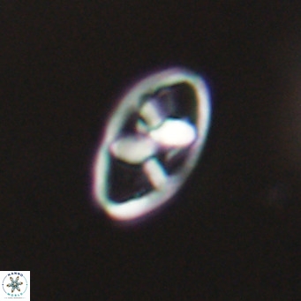 Neococcolithes dubius VR 30861