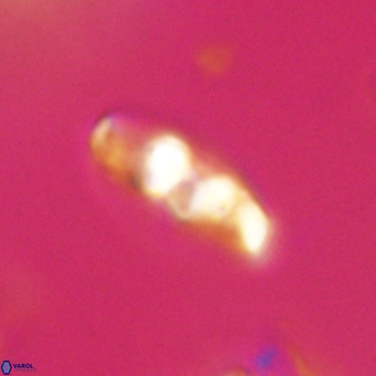 Neococcolithes dubius VR 30865