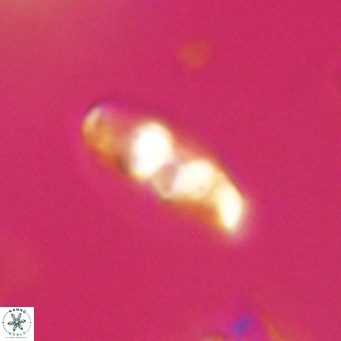 Neococcolithes dubius VR 30865