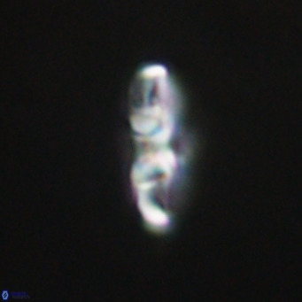 Neococcolithes dubius VR 30867