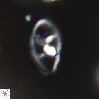 Neococcolithes dubius VR 30870