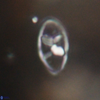Neococcolithes dubius VR 30871