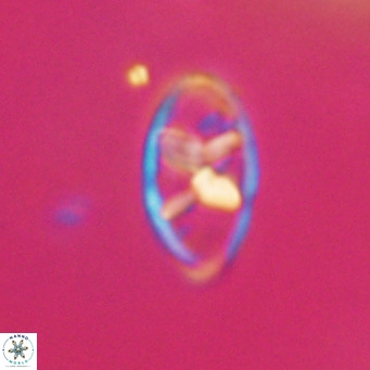 Neococcolithes dubius VR 30872