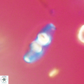 Neococcolithes dubius VR 30879