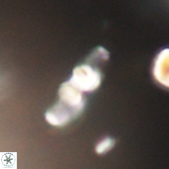 Neococcolithes dubius VR 30880