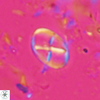 Neococcolithes leptostauros 25772