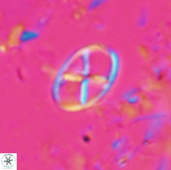 Neococcolithes leptostauros 25776