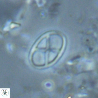 Neococcolithes leptostauros 25778