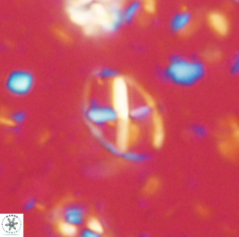 Neococcolithes leptostauros 59941
