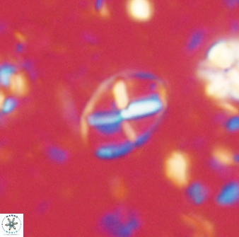 Neococcolithes leptostauros 59945