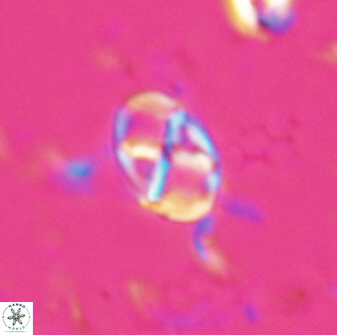 Neococcolithes protenus 25148