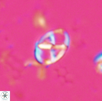 Neococcolithes protenus 25153