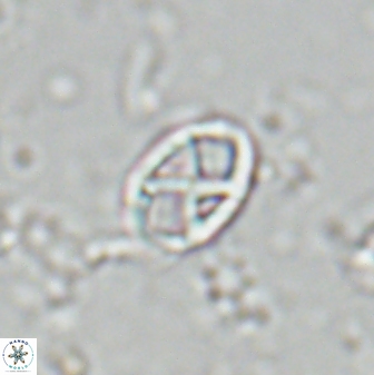 Neococcolithes protenus 25155