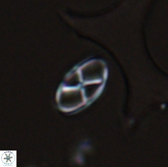 Neococcolithes protenus 25477