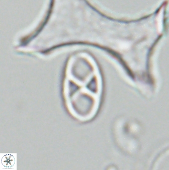 Neococcolithes protenus 25482