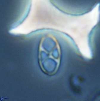 Neococcolithes protenus 25483