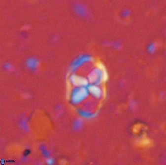 Neococcolithites lampros 45436