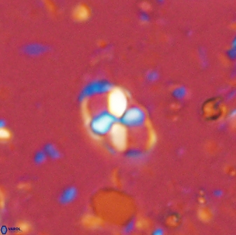 Neococcolithites lampros 45437