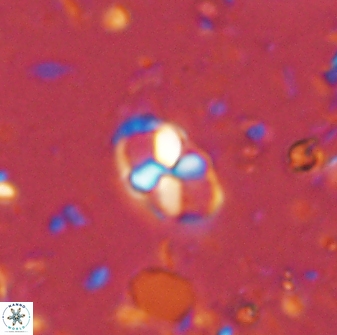 Neococcolithites lampros 45437