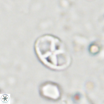 Neococcolithites lampros 45439
