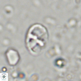 Neococcolithites lampros 45440