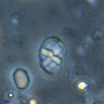 Neococcolithites lampros 45443