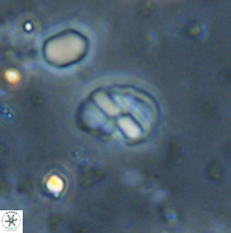 Neococcolithites lampros 45445