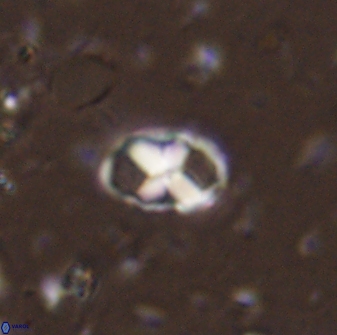 Neococcolithites lampros 45446