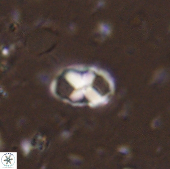 Neococcolithites lampros 45446