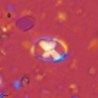 Neococcolithites lampros 45447