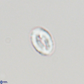 Neocrepidolithus neocrassus 22855