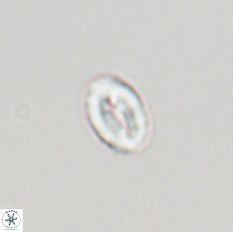 Neocrepidolithus neocrassus 22855