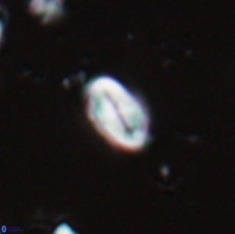 Neocrepidolithus neocrassus 22966