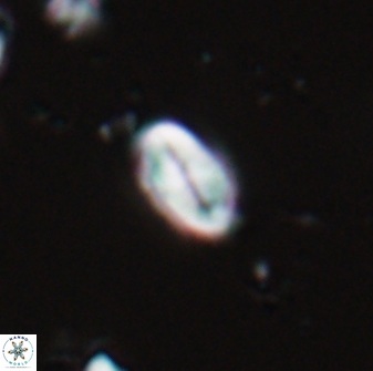 Neocrepidolithus neocrassus 22966