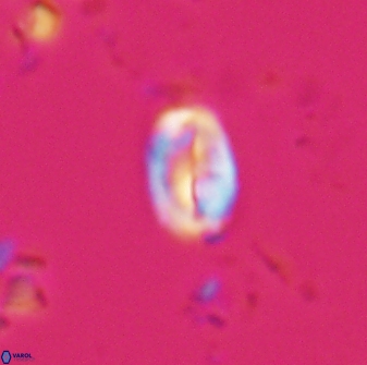 Neocrepidolithus neocrassus 22968