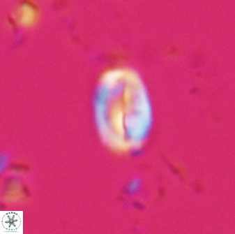 Neocrepidolithus neocrassus 22968
