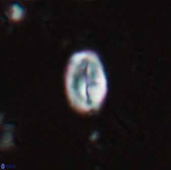 Neocrepidolithus neocrassus 22969