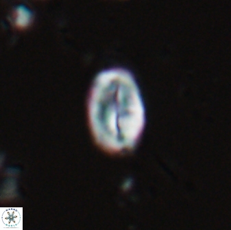 Neocrepidolithus neocrassus 22969