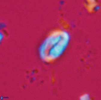 Neocrepidolithus neocrassus 22971