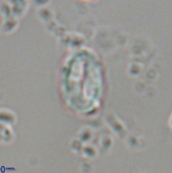 Neocrepidolithus neocrassus 22972